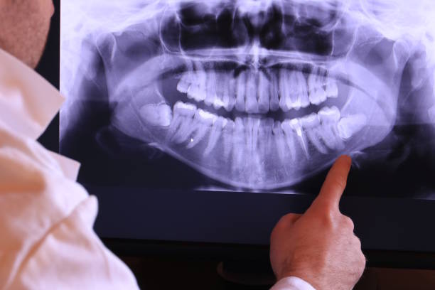 Best Orthodontic Emergency Dentist in North Liberty, IN