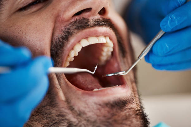 Best Emergency Dental Services for Seniors in North Liberty, IN